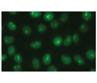 RecQL1 Antibody (G-2) - Immunofluorescence - Image 114062 