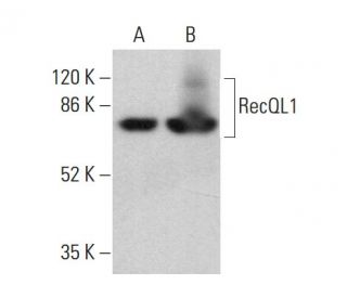 western blotting image from recommended RecQL1 (A-9) monoclonal antibody replacement. Image 360250