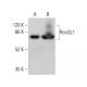 western blotting image from recommended RecQL1 (A-9) monoclonal antibody replacement. Image 360250