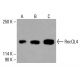 RecQL4 Antibody (B-3): sc-518189. Western blot analysis of RecQL4 expression in HeLa (A), K-562 (B) and HCT-116 (C) whole cell lysates. Detection reagent used: m-IgGκ BP-HRP: sc-516102. RecQL4 Antibody (B-3) - Western Blotting - Image 416479