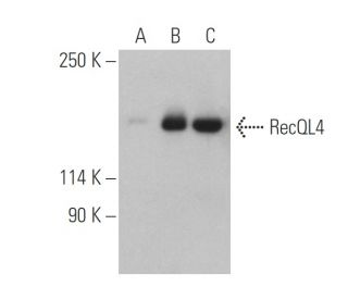 RecQL4 Antibody (B-3) - Western Blotting - Image 400815