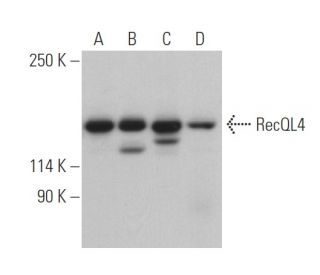 RecQL4 Antibody (B-3) - Western Blotting - Image 400816The Double Nickase Plasmid features a U6 promoter for sgRNA expression, a 20 nt targeting sequence, and a gRNA scaffold to guide Cas9n. It includes a CBh promoter for Cas9n (D10A) and puromycin resistance, GFP for transfection verification, and nuclear localization signals (NLS). The 2A peptide allows co-expression of Cas9n and Puro from a single promoter, enabling precise genome editing with reduced off-target effects.