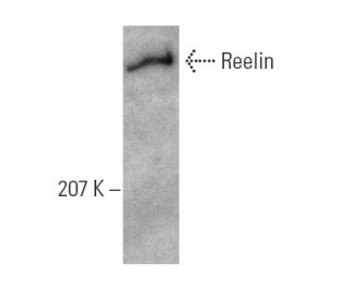 western blotting image from recommended Reelin (E-5) monoclonal antibody replacement. Image 6173