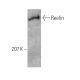 western blotting image from recommended Reelin (E-5) monoclonal antibody replacement. Image 6173