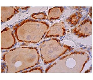 REEP5 Antibody (F-12) - Immunohistochemistry - Image 334006 