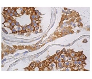 REEP6 Antibody (B-12) - Immunohistochemistry - Image 160993 