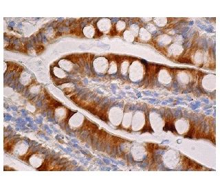 REEP6 Antibody (E-10) - Immunohistochemistry - Image 160992 