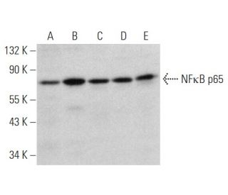 RELA/NFκB p65 Antibody (E-5) - Western Blotting - Image 333754