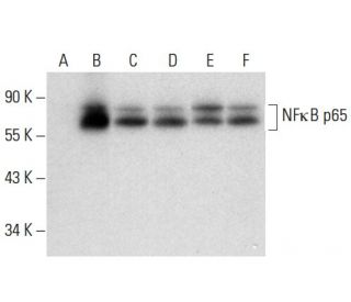 RELA/NF&kappa;B p65 Antibody (G-8) - Western Blotting - Image 304540 