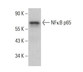 RELA/NFκB p65 Antibody (F-6) - Western Blotting - Image 380251