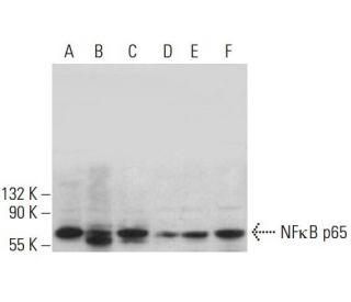 RELA/NFκB p65 Antibody (A-12) - Western Blotting - Image 380495
