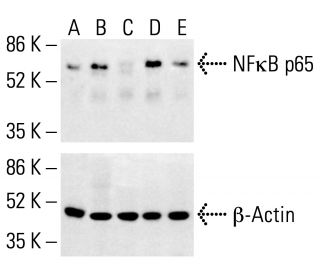 RELA/NFκB p65 Antibody (F-6) - Western Blotting - Image 412447