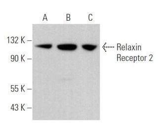 Relaxin Receptor 2 Antibody (H-4) - Western Blotting - Image 366590 