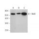 This polyclonal antibody has been discontinued. See our recommended <a href="relb-antibody-d-4">RelB (D-4)</a> monoclonal antibody (sample data shown). western blotting image from recommended RelB (D-4) monoclonal antibody replacement. Image 376073