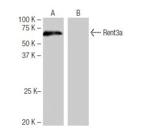 Rent3a Antibody (PL-B10) - Western Blotting - Image 65043