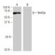 Rent3a Antibody (PL-B10) - Western Blotting - Image 65043