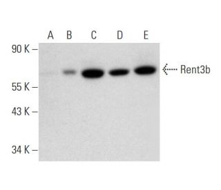 Rent3b Antibody (D-1) - Western Blotting - Image 324754Each CRISPR/Cas9 Knockout (KO) Plasmid product consists of a pool of 3 plasmids designed to ensure identification and cleavage of a specific gene for maximum knockout efficiency. Each plasmid encodes a unique 20 nt sequence derived from the GeCKO (v2) library.