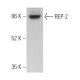 REP-2 Antibody (E-4) - Western Blotting - Image 369439 