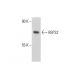 REPS2 Antibody (K-18) - Western Blotting - Image 136718 