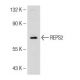 REPS2 Antibody (K-18) - Western Blotting - Image 146760 