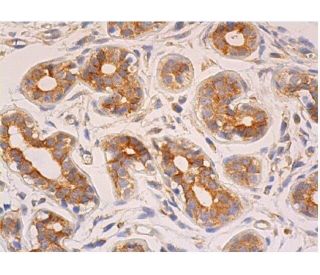 Ret Antibody (6E4C4) - Immunohistochemistry - Image 356403 
