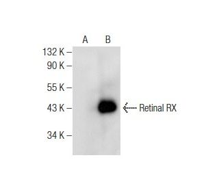 Retinal RX Antibody (H-7) - Western Blotting - Image 159891