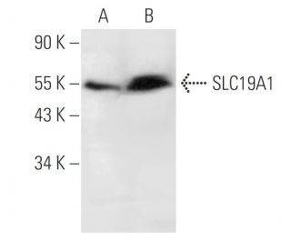 SLC19A1 Antibody (D-4) - Western Blotting - Image 291065 