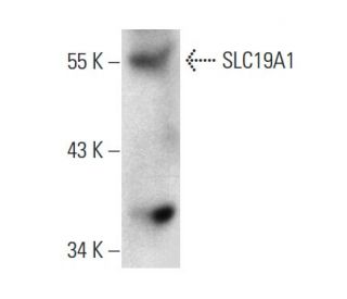 SLC19A1 Antibody (D-6) - Western Blotting - Image 131239 