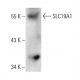 SLC19A1 Antibody (D-6) - Western Blotting - Image 131239 