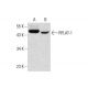 western blotting image from recommended RFLAT-1 (IP-2) monoclonal antibody replacement. Image 142745