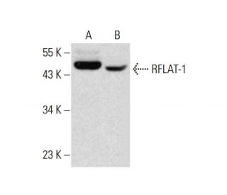 RFLAT-1 Antibody (IP-2) - Western Blotting - Image 142745 