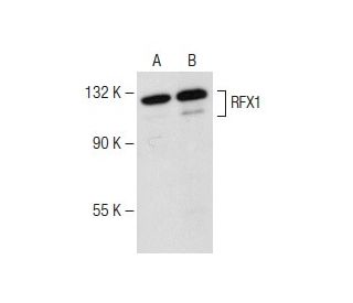 western blotting image from recommended RFX1 (F-6) monoclonal antibody replacement. Image 149629