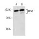 western blotting image from recommended RFX1 (F-6) monoclonal antibody replacement. Image 149629