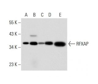RFXAP Antibody (RFXAD55A) - Western Blotting - Image 312934Each CRISPR/Cas9 Knockout (KO) Plasmid product consists of a pool of 3 plasmids designed to ensure identification and cleavage of a specific gene for maximum knockout efficiency. Each plasmid encodes a unique 20 nt sequence derived from the GeCKO (v2) library. 