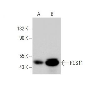 RGS11 Antibody (E-3) - Western Blotting - Image 346523 