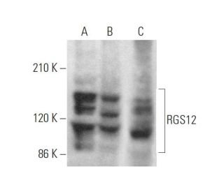 RGS12 Antibody (A-2) - Western Blotting - Image 371958 