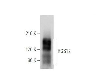 RGS12 Antibody (G-4) - Western Blotting - Image 318029 