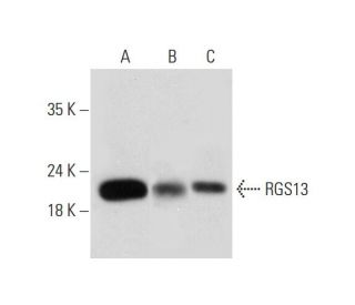 RGS13 Antibody (G-7) - Western Blotting - Image 331171 