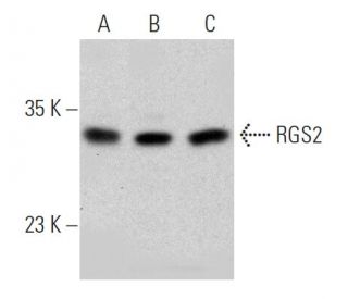 western blotting image from recommended RGS2 (BC-43) monoclonal antibody replacement. Image 368212