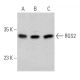 このポリクローナル抗体は販売終了となりました。弊社推奨の<a href="rgs2-antibody-bc-43">RGS2 (BC-43)</a>モノクローナル抗体をご覧ください(サンプルデータを表示)。 western blotting image from recommended RGS2 (BC-43) monoclonal antibody replacement. Image 368212