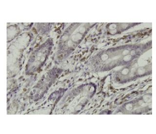 RGS3 Antibody (CC-Q7) - Immunohistochemistry - Image 36149 