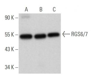 western blotting image from recommended RGS6/7 (F-10) monoclonal antibody replacement. Image 366712