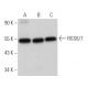 western blotting image from recommended RGS6/7 (F-10) monoclonal antibody replacement. Image 366712