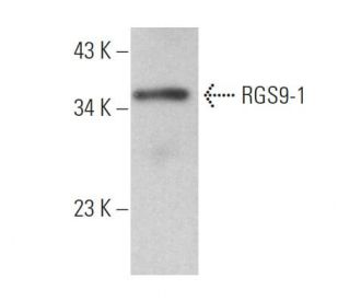 RGS9-1 Antibody (D3) - Western Blotting - Image 373082