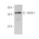 RGS9-1 Antibody (D3) - Western Blotting - Image 373082