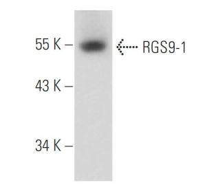 RGS9-1 Antibody (D7) - Western Blotting - Image 15659