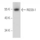 RGS9-1 Antibody (D7) - Western Blotting - Image 15659