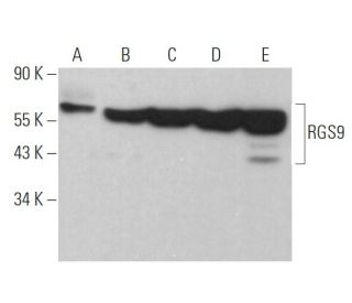 western blotting image from recommended RGS9 (C-8) monoclonal antibody replacement. Image 372932
