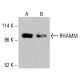 Anticorpo RHAMM (C-9): sc-515222. Análise por Western blot da expressão de RHAMM em lisados celulares completos de K-562 (A) e HCT-116 (B). Reagente de deteção utilizado: m-IgG Fc BP-HRP: sc-525409. RHAMM Antibody (C-9) - Western Blotting - Image 415893