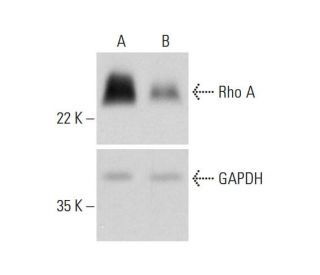 Rho A CRISPR/Cas9 KO Plasmid (h): sc-400052. Western blot analysis... 